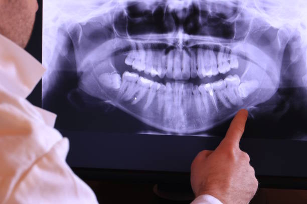 Best Emergency Root Canal Treatment in Chattanoo Valley, GA