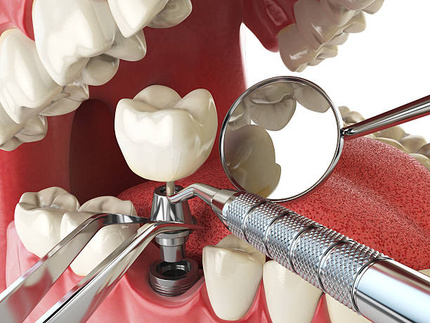 Best Emergency Dental Services for Seniors in Chattanoo Valley, GA